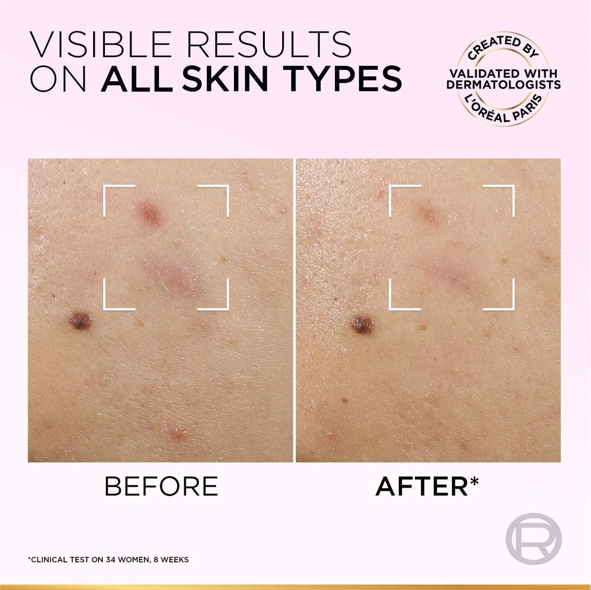 Glycolic Bright Anti-Dark Spot Exfoliant Peel