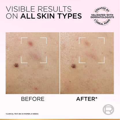 Glycolic Bright Anti-Dark Spot Exfoliant Peel